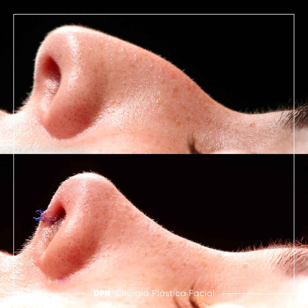 Antes e Depois - horizontal fotos escuras